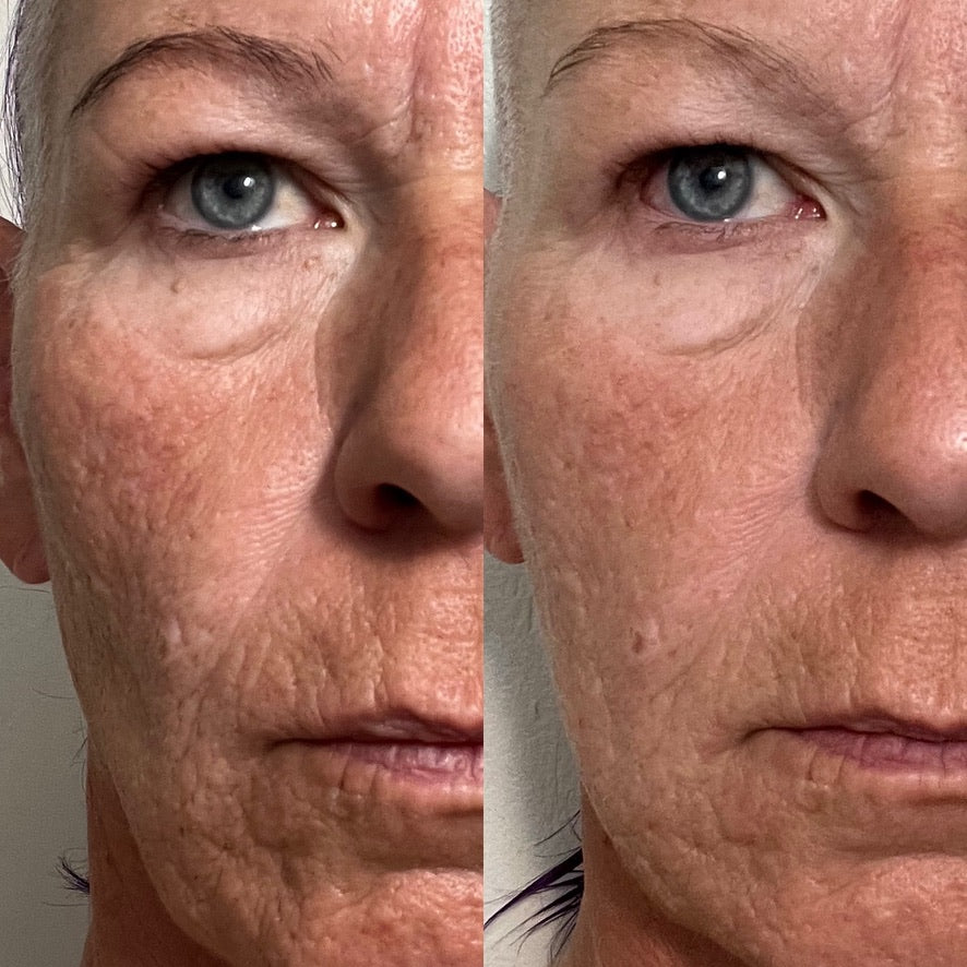 Before and After 30 day blind test.