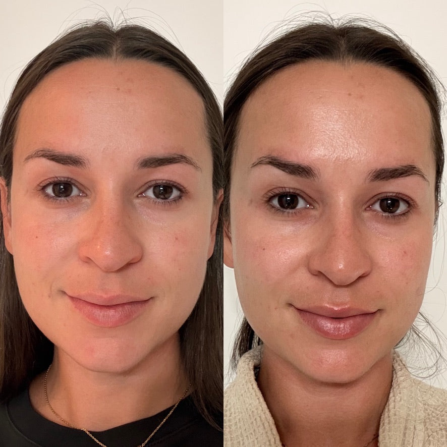 Before and After 30 day blind test.