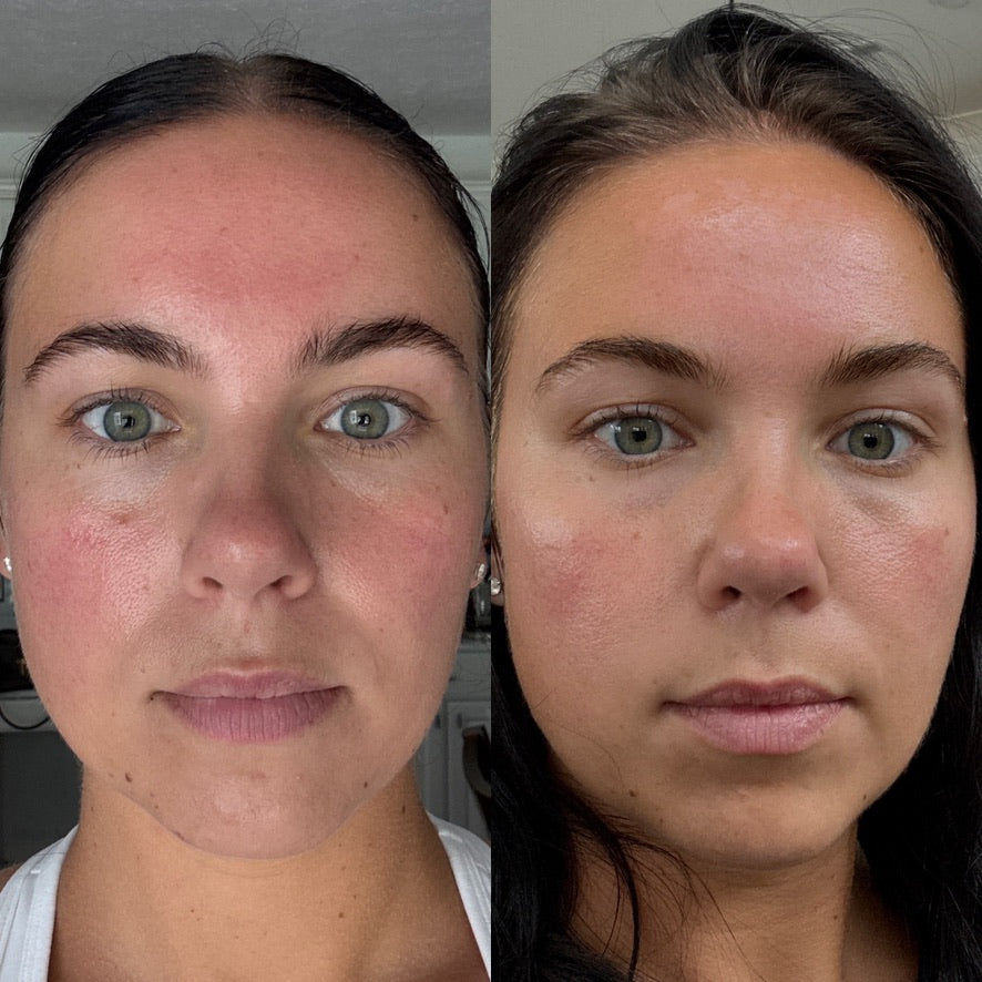 Before and After 30 day blind test