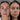 Before and After 30 day blind test