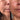 Before and After 30 day blind test.
