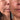 Before and After 30 day blind test.