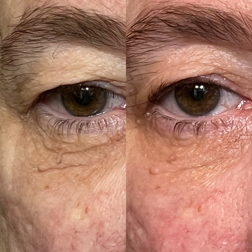 Before and After 30 day blind test.