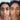 Before and After 30 day blind test.