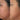 Before and After 30 day Blind test.